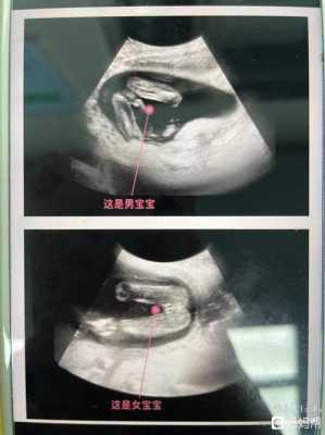 怀孕15周的症状,怀孕15周胎儿稳定了吗会胎停吗 第1张 怀孕15周的症状,怀孕15周胎儿稳定了吗会胎停吗 第1张