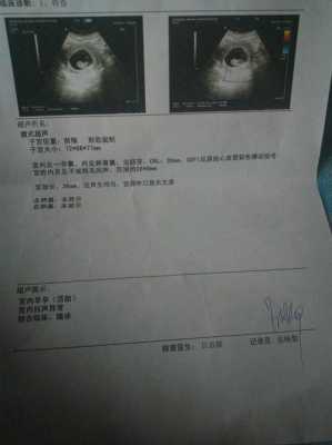 刚怀孕感冒了对胎儿有影响吗(怀孕的最初征兆1-14天) 第1张 刚怀孕感冒了对胎儿有影响吗(怀孕的最初征兆1-14天) 第1张