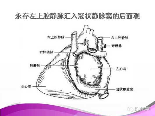 胎儿永存左上腔静脉是什么意思,四维检查胎儿永存左上腔静脉是什么意思 第1张 胎儿永存左上腔静脉是什么意思,四维检查胎儿永存左上腔静脉是什么意思 第1张