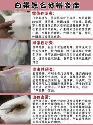 有妇科炎症容易怀孕吗,孕期妇科炎症会自愈吗 第1张 有妇科炎症容易怀孕吗,孕期妇科炎症会自愈吗 第1张