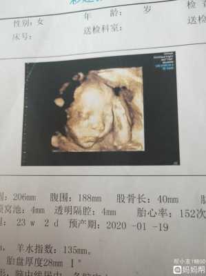 孕期四维检查最佳时间(四维多久做是最佳时间) 第3张 孕期四维检查最佳时间(四维多久做是最佳时间) 第3张