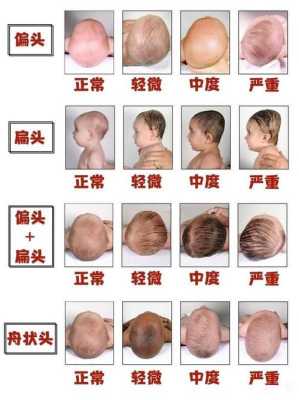 胎儿几个月定肤色(胎儿几个月定肤色如何让胎儿皮肤变白) 第1张 胎儿几个月定肤色(胎儿几个月定肤色如何让胎儿皮肤变白) 第1张