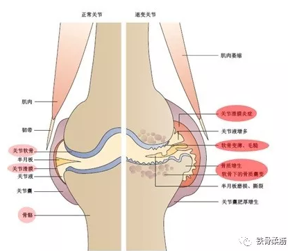 孕期膝盖疼是怎么回事（孕期膝盖疼是怎么回事 女性）  第2张