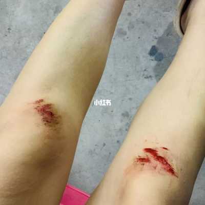 孕妇摔跤会吓着胎儿吗(孕妇摔跤会吓着胎儿吗) 第1张 孕妇摔跤会吓着胎儿吗(孕妇摔跤会吓着胎儿吗) 第1张