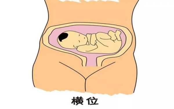 横位胎儿妈妈要注意什么（孕27周胎儿横位怎么办呢，这样的情况平时可以做操改善的吗）  第3张