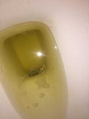 孕期尿路感染了对宝宝有影响不(孕妇尿完又想尿,下面老是有尿意) 第1张 孕期尿路感染了对宝宝有影响不(孕妇尿完又想尿,下面老是有尿意) 第1张