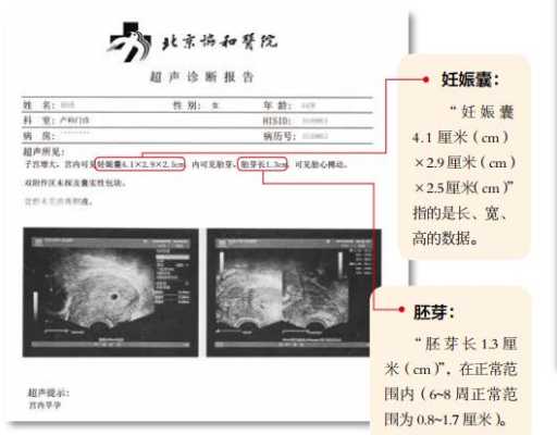 怀孕什么时候有胎心,胎儿几个月有胎心胎芽  第2张