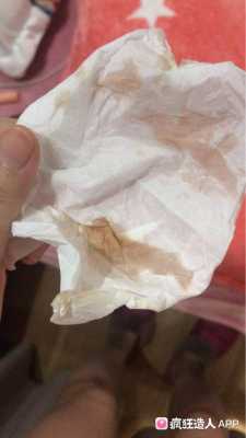 孕期出血正常吗(在易孕期出血正常吗) 第3张 孕期出血正常吗(在易孕期出血正常吗) 第3张