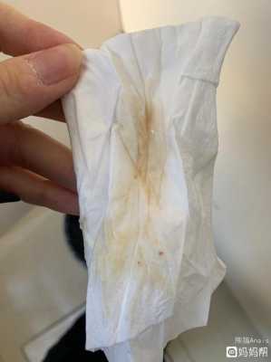 孕期出血正常吗(在易孕期出血正常吗) 第1张 孕期出血正常吗(在易孕期出血正常吗) 第1张