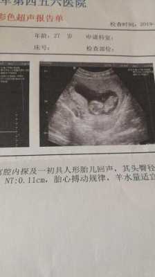 胎儿头小是什么原因(宝宝现在刚满月,头上有头伽怎么回事,要怎么去除) 第1张 胎儿头小是什么原因(宝宝现在刚满月,头上有头伽怎么回事,要怎么去除) 第1张