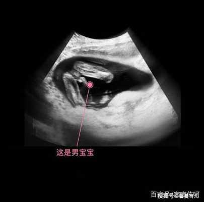 17周胎儿清晰大图(17周胎儿清晰大图男女) 第1张 17周胎儿清晰大图(17周胎儿清晰大图男女) 第1张
