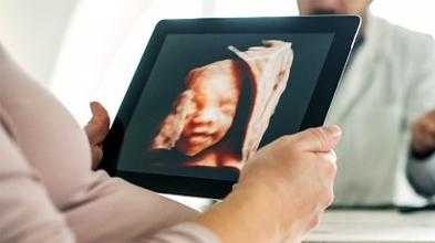 胎儿三级超声检查是什么,合项胎儿系统超声检查什么  第1张