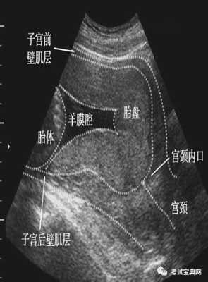 胎儿三级超声检查是什么,合项胎儿系统超声检查什么  第3张