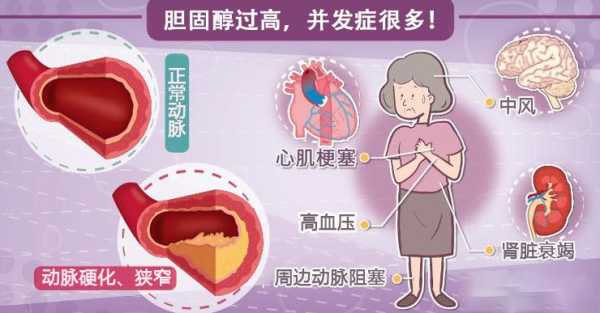 孕期胆固醇高(怀孕7个月胆固醇高怎么降下来) 第1张 孕期胆固醇高(怀孕7个月胆固醇高怎么降下来) 第1张