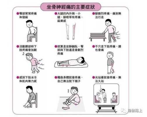 怀孕坐骨神经痛是什么原因造成的,孕期坐骨神经痛怎么办快速缓解 第1张 怀孕坐骨神经痛是什么原因造成的,孕期坐骨神经痛怎么办快速缓解 第1张