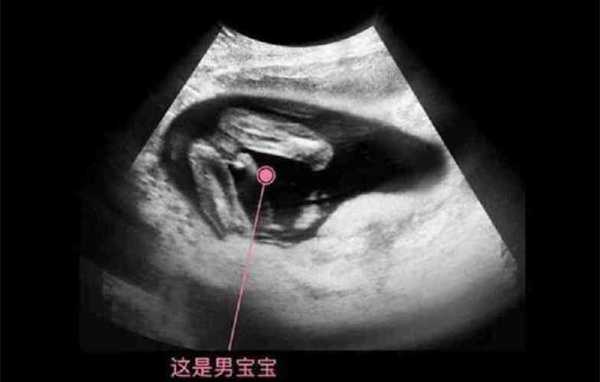 14周的孩子是几岁,14周胎儿多大参照物 第2张 14周的孩子是几岁,14周胎儿多大参照物 第2张
