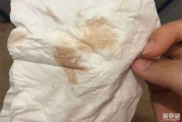 怀孕期间出血正常吗(女人怀孕期间出血正常吗) 第1张 怀孕期间出血正常吗(女人怀孕期间出血正常吗) 第1张