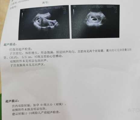 怀孕几周有胎心胎芽,一般胎儿几周有胎心胎芽 第2张 怀孕几周有胎心胎芽,一般胎儿几周有胎心胎芽 第2张