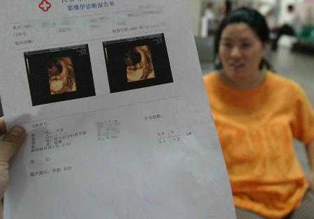 怀孕三个月胎儿彩超(三维彩超结果怎么看) 第2张 怀孕三个月胎儿彩超(三维彩超结果怎么看) 第2张