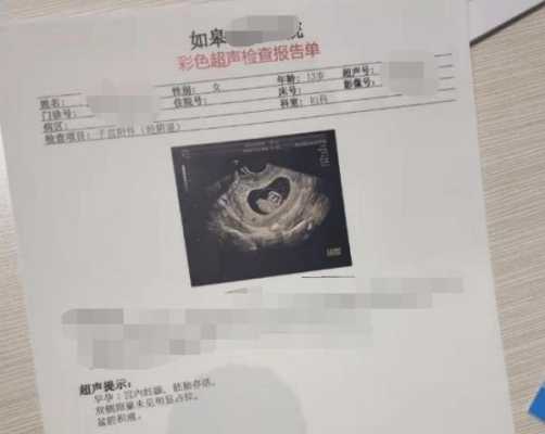 怀孕三个月胎儿彩超(三维彩超结果怎么看) 第3张 怀孕三个月胎儿彩超(三维彩超结果怎么看) 第3张