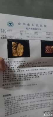 彩超对胎儿有没有影响（彩超到底有没有辐射）  第2张