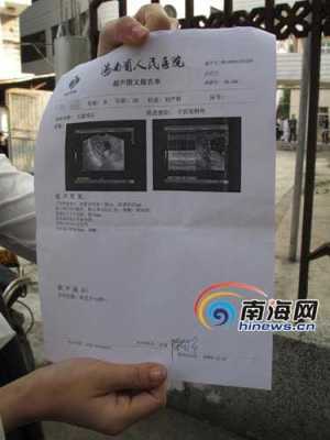 胎儿多大可以做人流(b超显示胎儿多大可以做人流) 第2张 胎儿多大可以做人流(b超显示胎儿多大可以做人流) 第2张