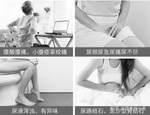 怀孕会尿频吗,孕期尿频是怎么回事女性 第3张 怀孕会尿频吗,孕期尿频是怎么回事女性 第3张