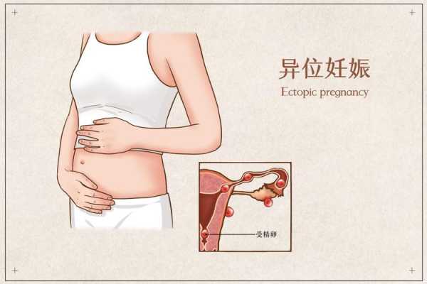 怀孕期间肚子疼正常吗(怀孕期间肚子疼正常吗做什么检查) 第2张 怀孕期间肚子疼正常吗(怀孕期间肚子疼正常吗做什么检查) 第2张