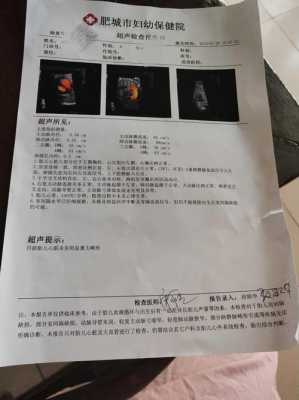 胎儿心脏彩超和四维彩超的区别(做四维彩超给宝宝查心脏吗) 第2张 胎儿心脏彩超和四维彩超的区别(做四维彩超给宝宝查心脏吗) 第2张