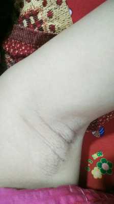 孕期腋窝变黑怎么回事(怀孕腋下变黑怎么办) 第2张 孕期腋窝变黑怎么回事(怀孕腋下变黑怎么办) 第2张