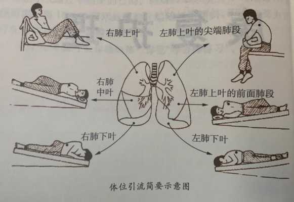 怀孕时打促肺针后来足月顺产出来,孩子应该没事吧,促进胎儿肺成熟的针叫什么多少钱 第2张 怀孕时打促肺针后来足月顺产出来,孩子应该没事吧,促进胎儿肺成熟的针叫什么多少钱 第2张