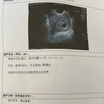 让胎儿停止胎心的方法(让胎儿停止胎心的方法5个月) 第1张 让胎儿停止胎心的方法(让胎儿停止胎心的方法5个月) 第1张