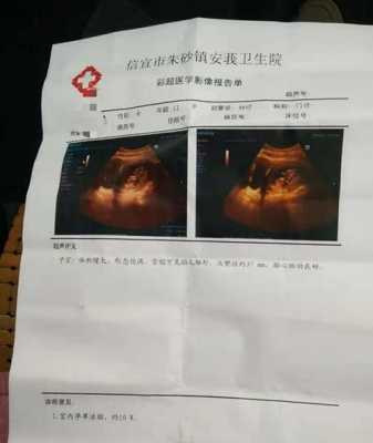 怀孕8个月长时间坐着好吗,孕妇一天坐10小时要紧吗 第1张 怀孕8个月长时间坐着好吗,孕妇一天坐10小时要紧吗 第1张