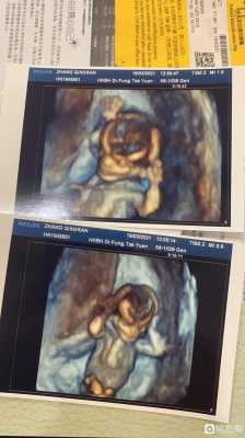 13周胎儿多大（怀孕13周胎儿多大）  第3张