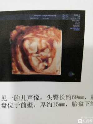 13周胎儿多大（怀孕13周胎儿多大）  第2张