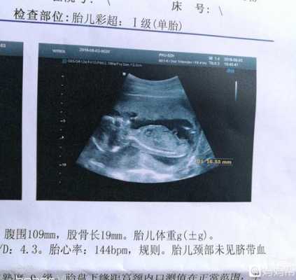 孕十七周胎儿有多大,孕17周胎儿多大图片  第1张