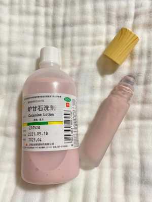 孕期头皮屑特别多怎么办(孕期头皮屑特别多怎么办可以用炉甘石洗剂吗) 第1张 孕期头皮屑特别多怎么办(孕期头皮屑特别多怎么办可以用炉甘石洗剂吗) 第1张