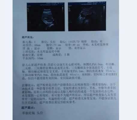 胎儿心超(胎儿心超几周做最合适) 第1张 胎儿心超(胎儿心超几周做最合适) 第1张