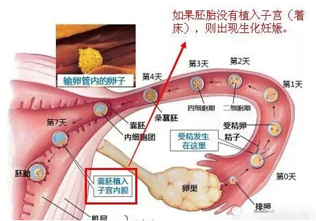 什么是生化妊娠,有什么症状,胎儿生化是怎么回事  第2张