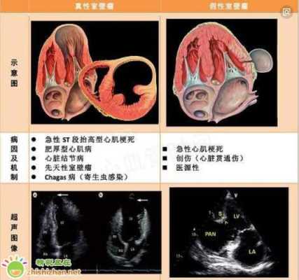 胎儿左心室强光点(胎儿左心室强光点是什么意思) 第2张 胎儿左心室强光点(胎儿左心室强光点是什么意思) 第2张