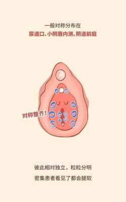 孕期下面痒怎么办(阴道口发痒怎么办) 第1张 孕期下面痒怎么办(阴道口发痒怎么办) 第1张
