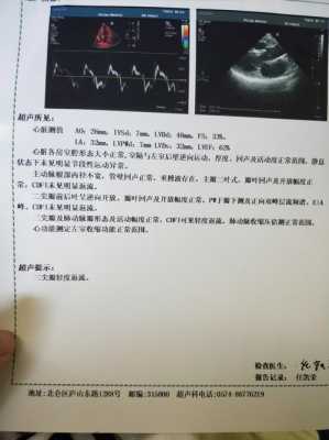 孕妇查胎儿心脏彩超价格是多少,胎儿心脏彩超必须要做吗  第2张