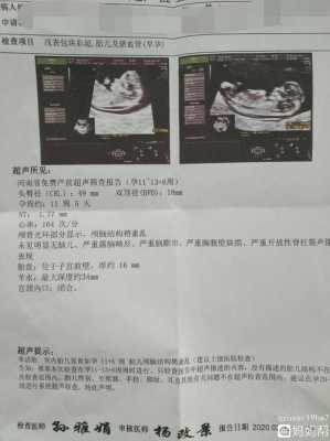胎儿nt值正常范围(产检nt值多少正常) 第2张 胎儿nt值正常范围(产检nt值多少正常) 第2张