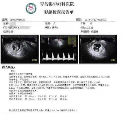 孕妇nf检查是什么意思,胎儿NF是什么意思 第3张 孕妇nf检查是什么意思,胎儿NF是什么意思 第3张