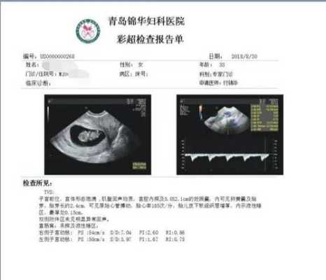孕妇nf检查是什么意思,胎儿NF是什么意思 第2张 孕妇nf检查是什么意思,胎儿NF是什么意思 第2张