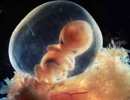 三个月胎儿多大,怀孕三个月胎儿成型了吗  第2张