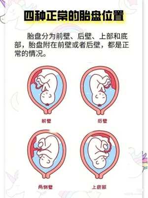 胎盘低对胎儿有影响吗(胎盘低对胎儿有影响吗孕六个月了) 第2张 胎盘低对胎儿有影响吗(胎盘低对胎儿有影响吗孕六个月了) 第2张