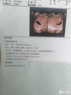 胎儿几周能听到胎心(胎儿几周能听到胎心胎芽) 第1张 胎儿几周能听到胎心(胎儿几周能听到胎心胎芽) 第1张