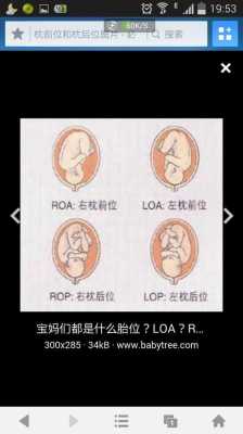 左枕后位胎儿图(枕前位与枕后位的区别) 第3张 左枕后位胎儿图(枕前位与枕后位的区别) 第3张
