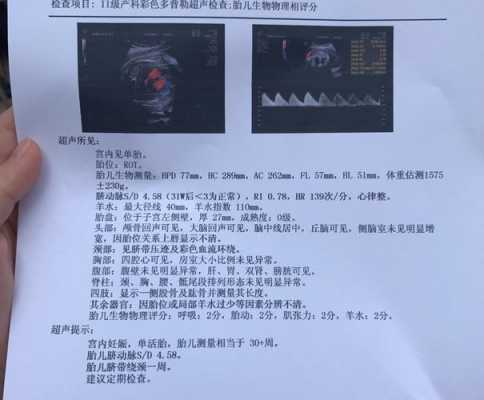 胎儿sd值偏高怎么回事(孕32周、检查出SD值高,达到3,是不是宝宝会危险) 第2张 胎儿sd值偏高怎么回事(孕32周、检查出SD值高,达到3,是不是宝宝会危险) 第2张